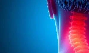 Schmerzhafte Myogelose im Nackenbereich, dargestellt durch rote Hitze entlang der Halswirbelsäule.