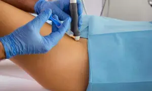 Czy to skręcenie biodra? Objawy, leczenie i kiedy do lekarza