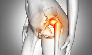 Czerwone, pulsujące ciepło w stawie biodrowym sugeruje ból biodra. Anatomia człowieka z zaznaczonym problemem.