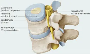 Anatomische Darstellung: wo ist die bandscheibe? Sie besteht aus Gallertkern und Faserring, eingebettet zwischen Wirbelkörpern. Der Spinalkanal verläuft dahinter.