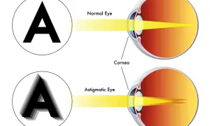 Astygmatyzm: Okulista czy optometrysta? Rozwiej wątpliwości i zobacz ostro!