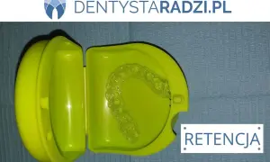 Przezroczysty retainer w zielonym etui, niezbędny do utrzymania efektów leczenia ortodontycznego. Retencja to klucz do pięknych zębów po aparacie.