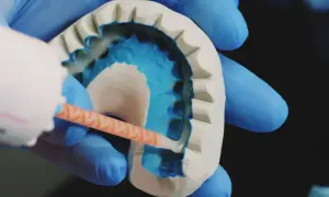Pęknięta proteza zębowa? Apteczny klej, ale unikaj Super Glue!