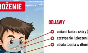 Chłopiec z bladą skórą i zmarzniętymi dłońmi, objawy odmrożenia: bladość, pieczenie, utrata czucia.