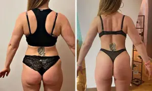 Prima e dopo: la trasformazione di una donna con glutei perfetti, più tonici e scolpiti.