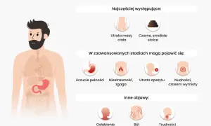 Objawy raka żołądka: utrata masy ciała, czarne stolce, uczucie pełności, niestrawność, zgaga, utrata apetytu, nudności, wymioty, osłabienie, ból pleców, trudności w połykaniu.