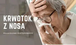 Starszy mężczyzna z okularami przykłada chusteczkę do nosa, doświadczając krwotoku z nosa. Tekst informuje o prawidłowym postępowaniu.