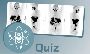 Images de médecine nucléaire, montrant des scans corporels en coupe. Un symbole atomique et le mot "Quiz" sont superposés.