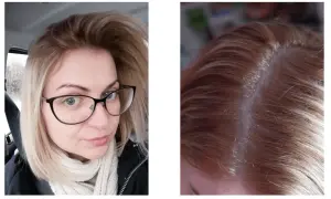 Kobieta z okularami i jasnymi, blond włosami. Widoczne odrosty na głowie.