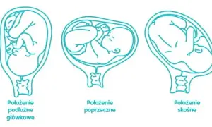 Kiedy płód układa się do porodu i co to oznacza dla mamy?