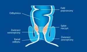 Schemat budowy odbytnicy z zaznaczonym splotem naczyń, który może być przyczyną hemoroidów.