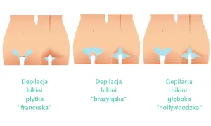 Czy depilatorem laserowym można golić miejsca intymne bez bólu?