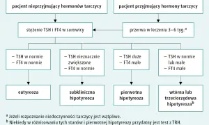 Schemat diagnostyki niedoczynności tarczycy. Czy przed badaniem TSH brać Euthyrox? Pacjent przyjmujący hormony tarczycy powinien zrobić przerwę w leczeniu.