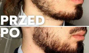 Jak zmiękczyć zarost i uniknąć szorstkości brody na zawsze