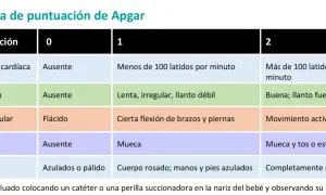 Tabla del test de Apgar: evalúa frecuencia cardíaca, respiración, tono muscular, reflejos y color del bebé.