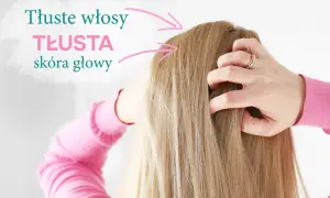 Dłonie wplatają się w blond włosy, wskazując na problem przetłuszczającej się skóry głowy. Szukasz rozwiązania co na przetłuszczające się włosy?