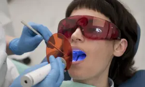 Pacjentka w okularach ochronnych poddaje się zabiegowi stomatologicznemu. Dentysta używa lampy polimeryzacyjnej, która emituje niebieskie światło. Po piaskowaniu zębów, taka kawa z mlekiem smakuje jak nagroda.