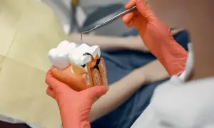 Model zęba pokazuje, co to endodoncja: leczenie kanałowe. Dentysta w rękawiczkach pokazuje uszkodzony ząb.