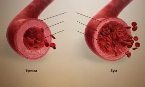 Przekrój tętnicy i żyły z widocznymi krwinkami. Tętnica ma grubsze ściany, żyła cieńsze i szersze światło.
