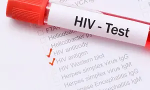 HIV: Jakie badanie wybrać? Kiedy wynik jest wiarygodny?
