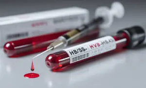 HBsAg: Dodatni czy ujemny? Zrozum swój wynik i zadbaj o wątrobę
