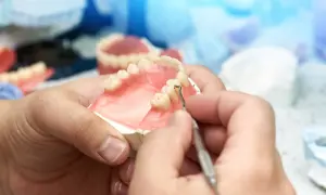 Protetyk stomatologiczny pracuje nad protezą zębową, która może być refundowana przez NFZ.