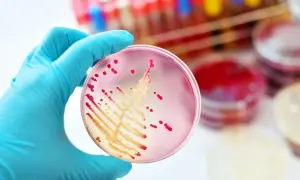 Rękawiczka w niebieskiej rękawiczce trzyma szalkę Petriego z czerwonymi koloniami bakterii, być może Klebsiella pneumoniae, na różowym podłożu.