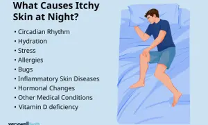 A man in bed scratches his leg, illustrating causes of itchy skin at night, like allergies or bed sheets making me itch.