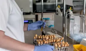 Laborantka w niebieskich rękawiczkach analizuje próbkę, która może zawierać dane o poziomie dehydrogenazy mleczanowej.