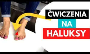 Domowe ćwiczenia na haluksy: Zwalcz ból i zatrzymaj deformację