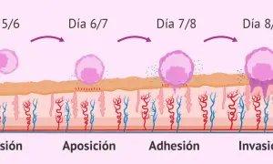 Ilustración de la implantación embrionaria: eclosión, aposición, adhesión e invasión del blastocisto en el endometrio.