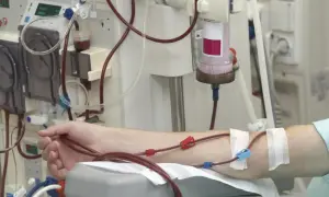 Ramię pacjenta podłączone do maszyny do dializy. Czerwone i niebieskie złącza przewodów widoczne na skórze.