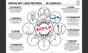 Piaskowanie zębów AIRFLOW® PLUS 14 µm usuwa biofilm i osady. Jak często? W zależności od potrzeb pacjenta, dla zdrowego uśmiechu.