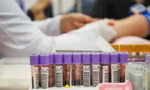 Próbki krwi w probówkach z fioletowymi nakrętkami czekają na analizę. W tle widać pobieranie krwi, co może pomóc w ocenie crp norma.