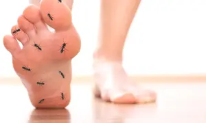 Mrówki na stopie symbolizują mrowienie i drętwienie, objawy neuropatii cukrzycowej.