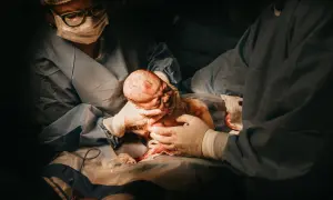Cesarskie cięcie: Fizjoterapeuta kiedy i czego się spodziewać?