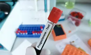 Probówka z napisem "Progesterone - Test" w laboratorium. Badanie progesteronu u kobiet jest kluczowe w diagnostyce cyklu miesiączkowego i ciąży.