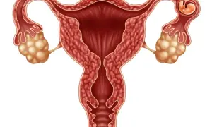 Ciąża pozamaciczna: Objawy, diagnostyka, leczenie. Co musisz wiedzieć?