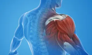 Contractura muscular: Identifica el "nudo" y dile adiós al dolor.