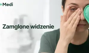 Kobieta z zieloną opaską na oku, doświadczająca zamglonego widzenia w jednym oku.