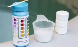 Teststreifen für den ph-wert pool, daneben ein Messbecher mit weißem Pulver und Tabletten.