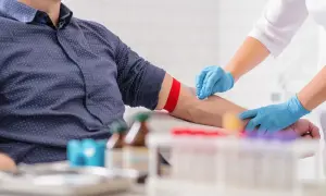 Pobieranie krwi do badań. Rękawiczki i opaska uciskowa na ramieniu pacjenta. W tle probówki i leki. Analiza rdw-sd.