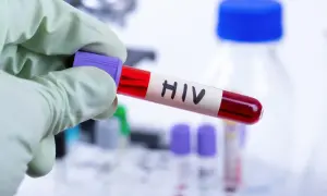 Rękawiczka ochronna trzyma probówkę z krwią oznaczoną "HIV". W tle widać sprzęt laboratoryjny, sugerujący badania nad wirusem i jego objawami u mężczyzn.