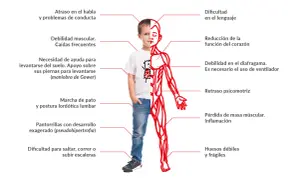Un niño muestra los efectos de la distrofia muscular de Duchenne: debilidad muscular, problemas de lenguaje, cardíacos y respiratorios, entre otros.
