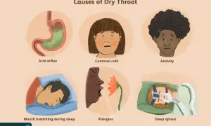 Illustration shows causes of dry throat: acid reflux, common cold, anxiety, mouth breathing during sleep, allergies, and sleep apnea.
