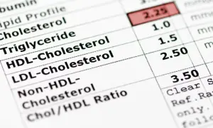 Wyniki badań krwi: cholesterol, triglicerydy. Czas oczekiwania na wyniki zależy od laboratorium.