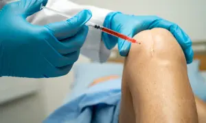 Jak długo boli kolano po kwasie hialuronowym? Oczekiwania i porady