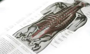 Anatomische Zeichnung des Rückens mit detaillierter Darstellung der Muskulatur, einschließlich des Iliocostalis.