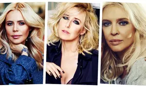 Trzy blondynki, które gwiazdy otwarcie przyznają się do zabiegów medycyny estetycznej.