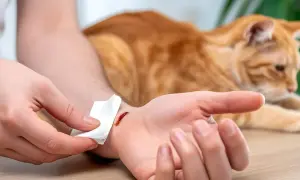 Opieka nad kotem po ugryzieniu. Na dłoni widać otwarte rany, a obok leży rudy kot.